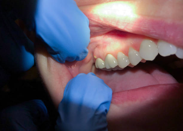 Best Same-Day Emergency Dentist in Huntsville, TX