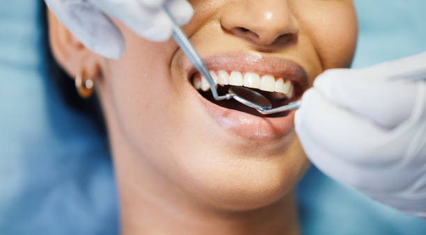 Best Emergency Tooth Extraction in Huntsville, TX