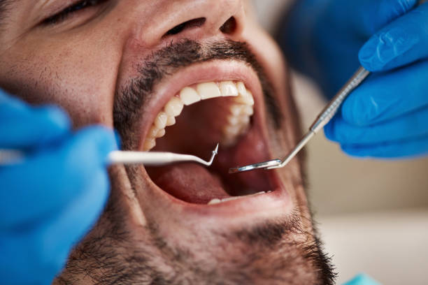 Best Weekend Emergency Dentist in Huntsville, TX